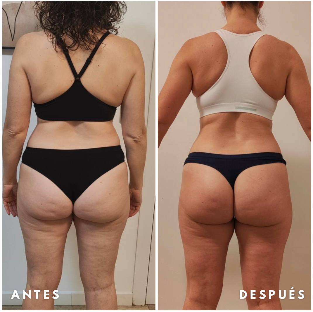 Transformación antes y después