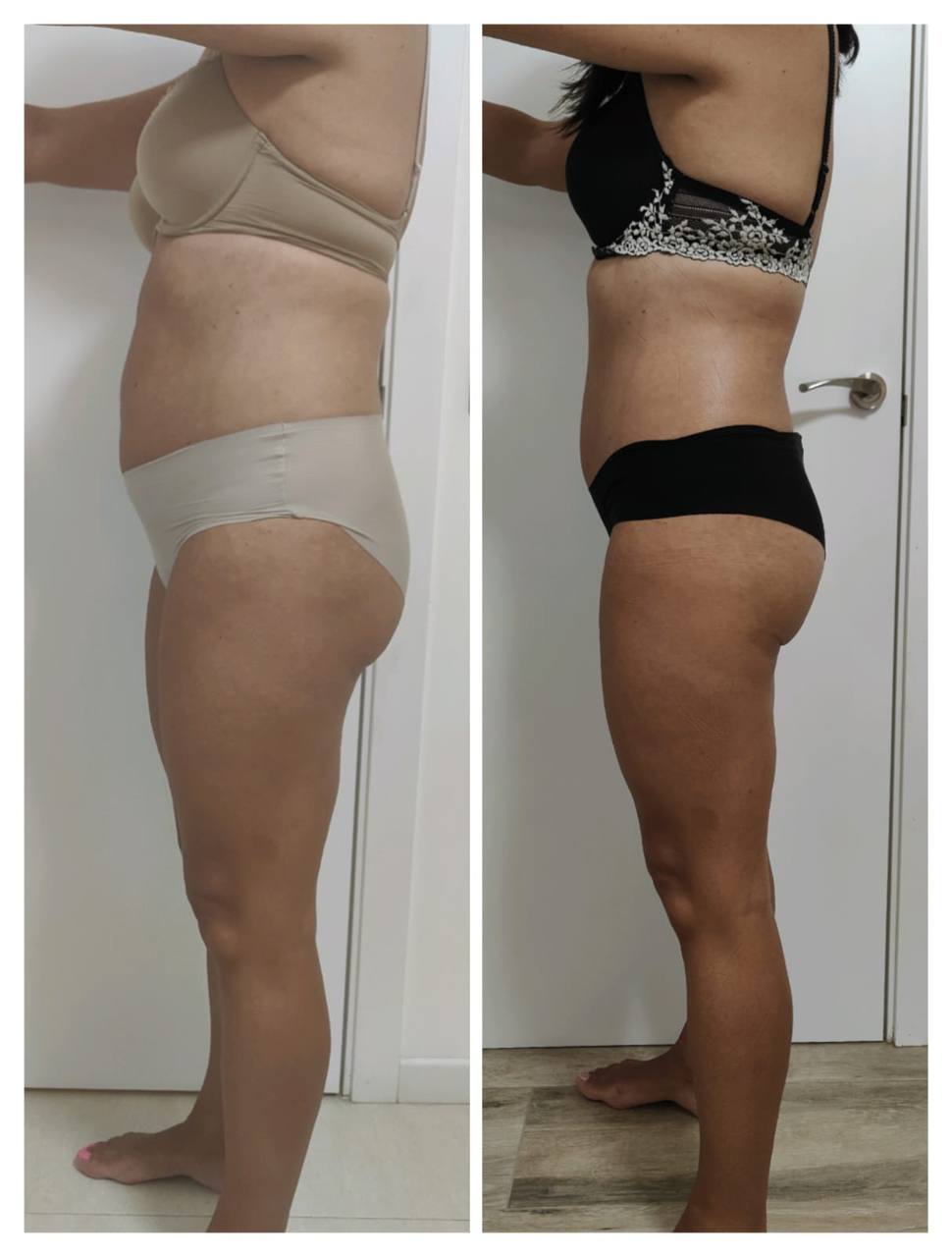 Transformación antes y después